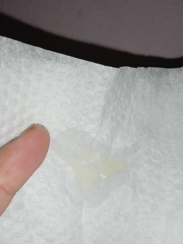 Sekarang 35minggu tepat, ini mucus or lendir keputihan ya?