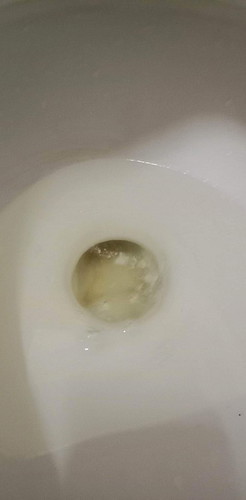 38 วีค 6 วัน มีมูกแบบนี้ไปรพ.เลยมั้ยค่ะ