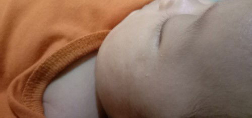 Bintik putih di wajah