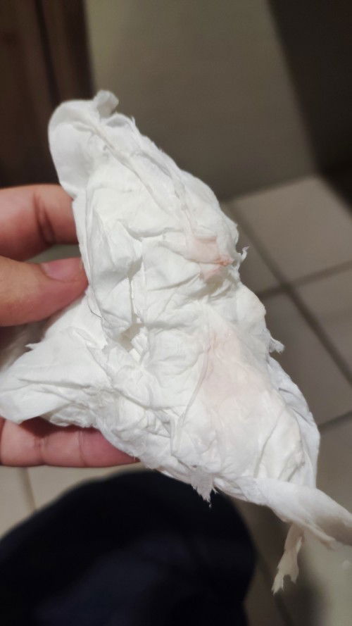 Flek implantasi atau haid?