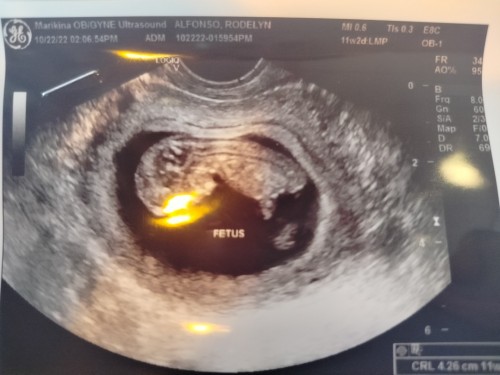 Okey lng ba uminom ng gamot sa hepa b
Resita nmn sya ng ob ko
3month pregnant na po 🤰🤰🤰🤰🤰🤰🤰