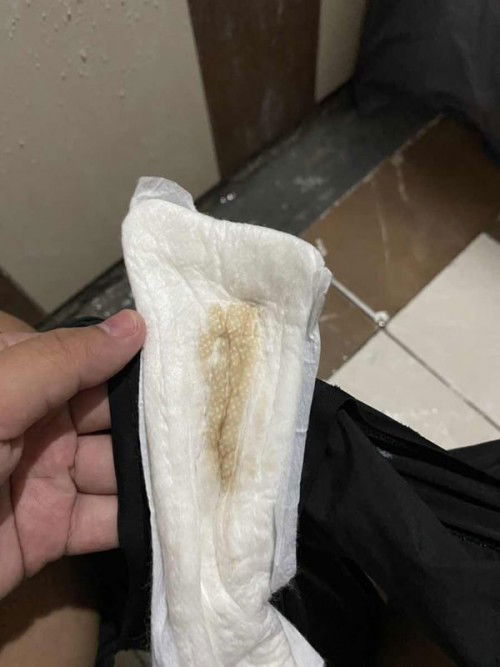 Brown Discharge at 38 weeks