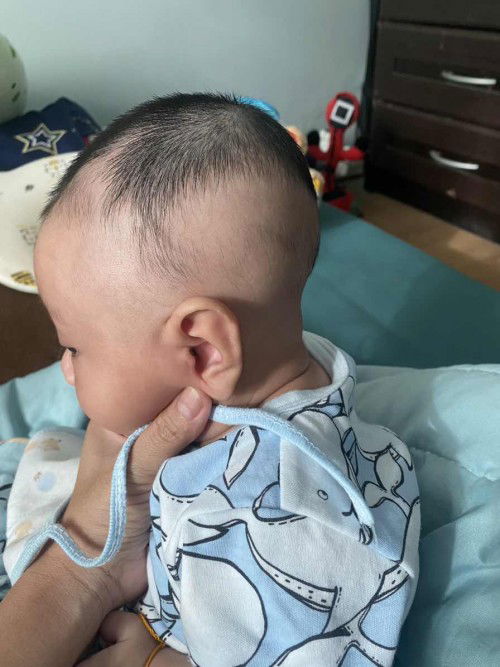 หัวน้องแบนไหมคะแบบนี้ แม่เริ่มหนักใจกลัวน้องหัวแบน