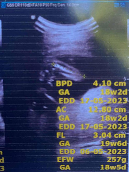 แบบนี้หนูเป็น ผู้หญิง หรือ ผู้ชายคะ