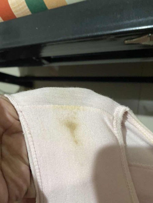 Flek coklat usia 7weeks