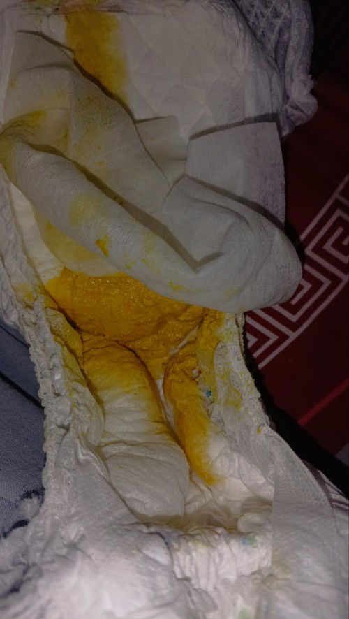 Bayi usia 5 bulan sering pup