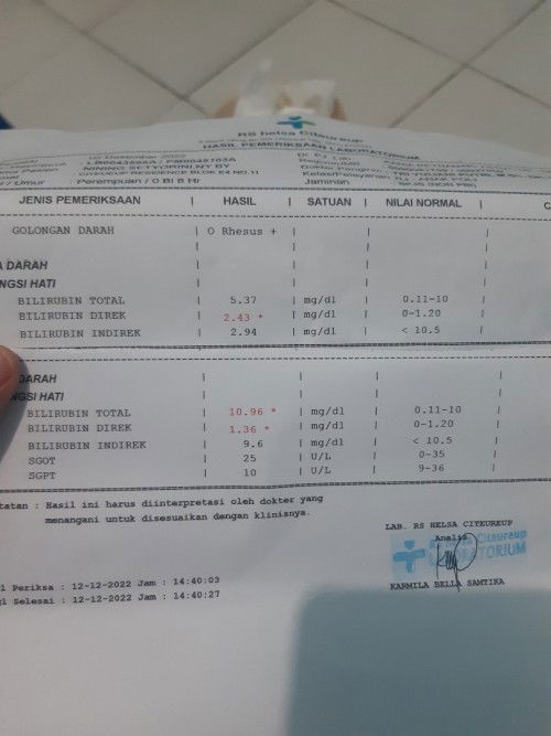 Ada yg bayi nya kuning dan cek bilirubin direk tinggi dan terapi urdafalk