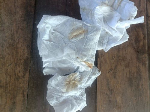 เตือนภัย ก่อนจะสายไป