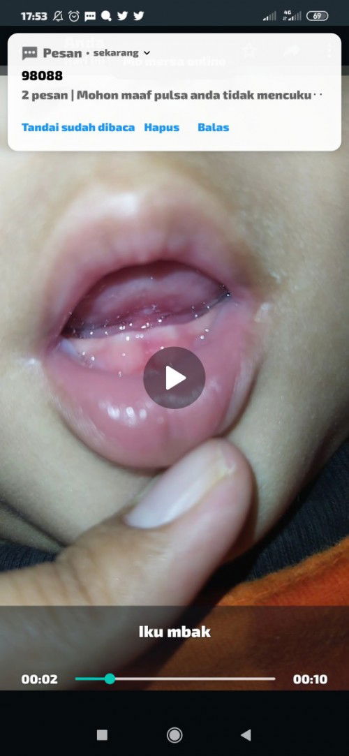 BAYI 7 BULAN TIDAK MAU MENYUSU