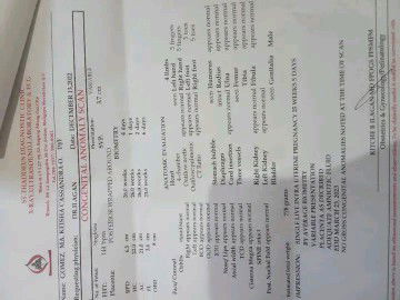 PATINGIN NAMAN PO IF MAY DAPAT AKONG IKA WORRY??