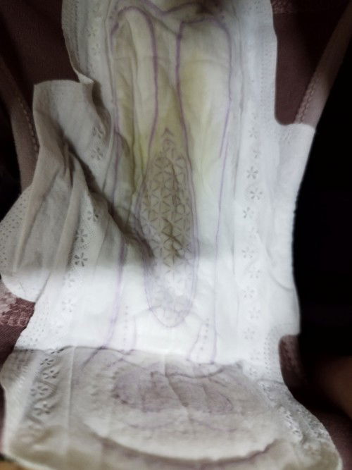 Keputihan atau ketuban