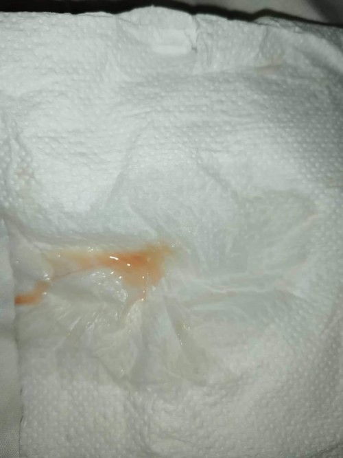 Macus plug napo ba ito?