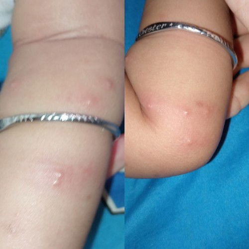 Apa alergi susu sapi