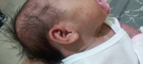 Ano kaya ito nasa balat ng anak ko? Ano po kaya pwede gamot dito?