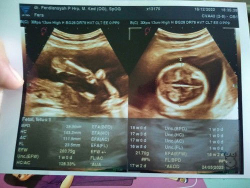 Hasil usg placenta bawah