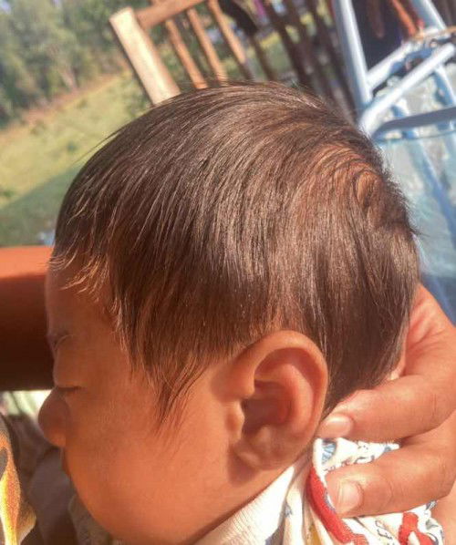 แบบนี้น้องหัวแบนไหมค่ะ??