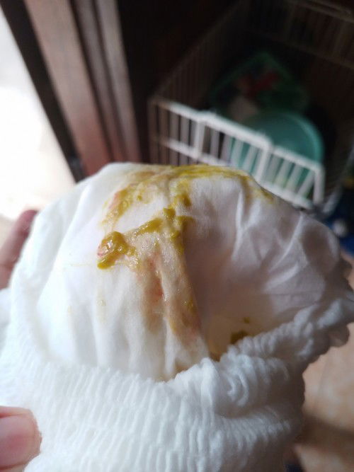 Diare pada anak 9bulan