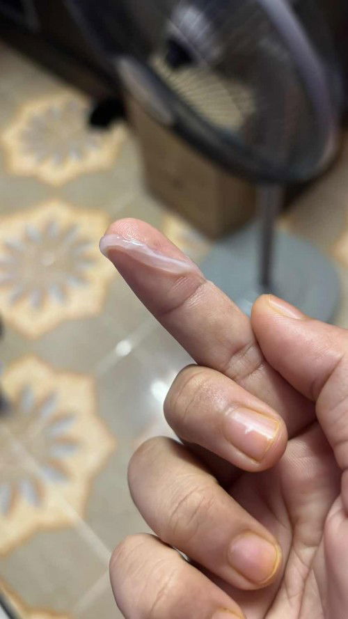 Keluar lendir dan rasa ngilu