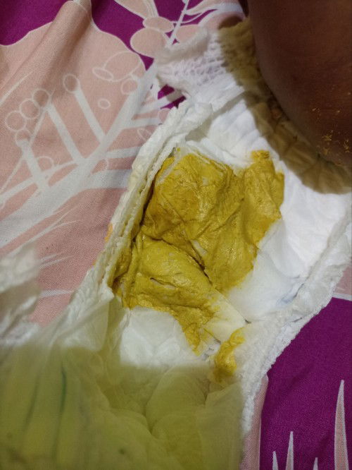 Tekstur Fases 3 Bulan