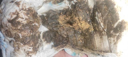 Poops ni baby 4months old okay lang poba yung poop nya na ganyan mga momshiee ?