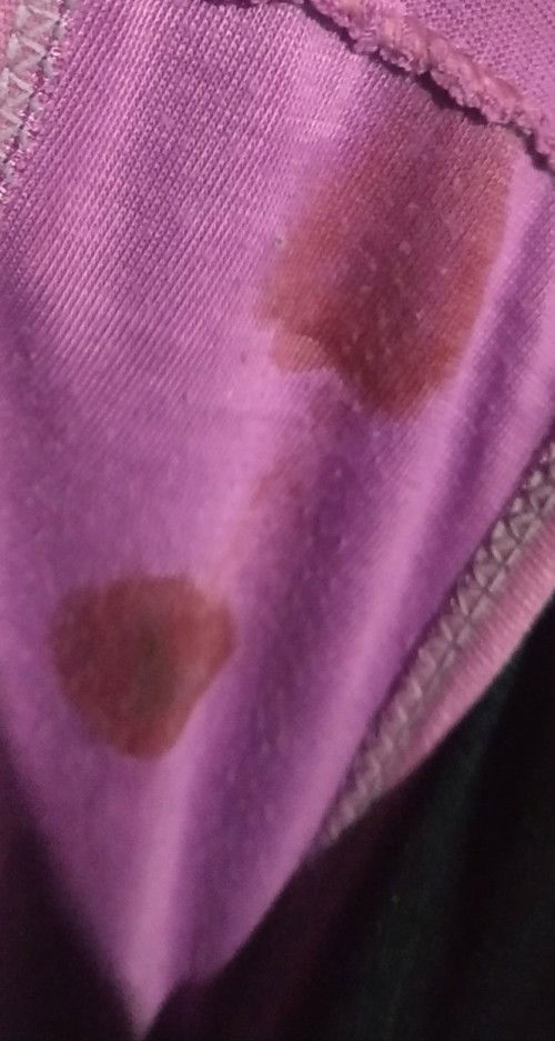 Keluar darah segar , UK 38week