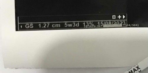 GA dengan hasil usg berbeda