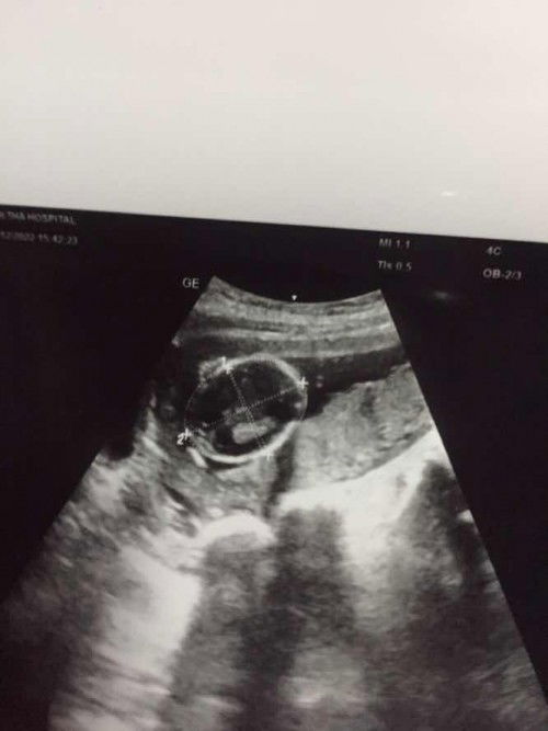 อยากทราบลายละเอียด