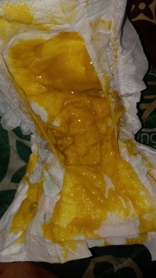 Poop pasagot po maraming salamat