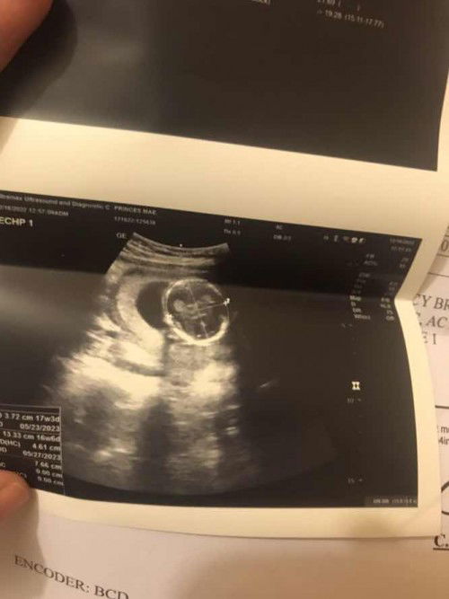 Ano gender ni baby🥺🥺