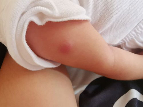 Mga miii, ano po kaya ito nagsimula sa maliit bglang lumaki ng gnyan