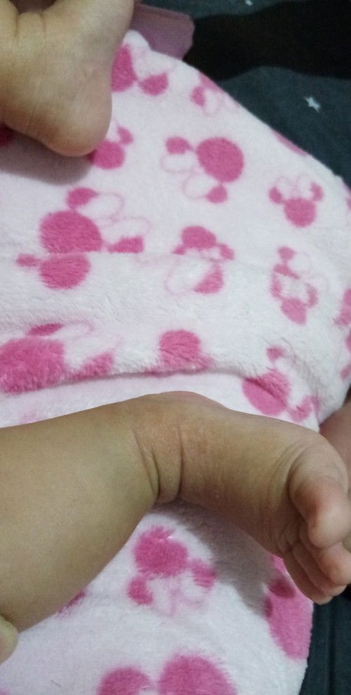 Dry skin 2 months old. Sana mapansin pls