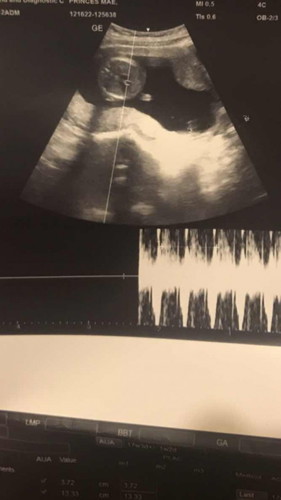 Gender ni Baby🥺🥺
