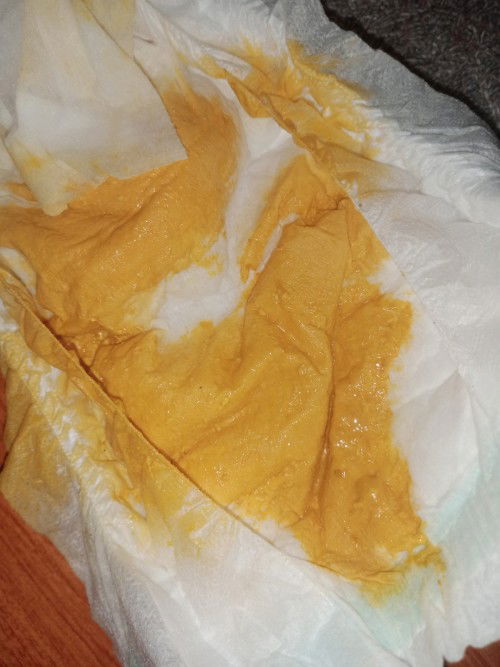 ทารกท้องเสีย