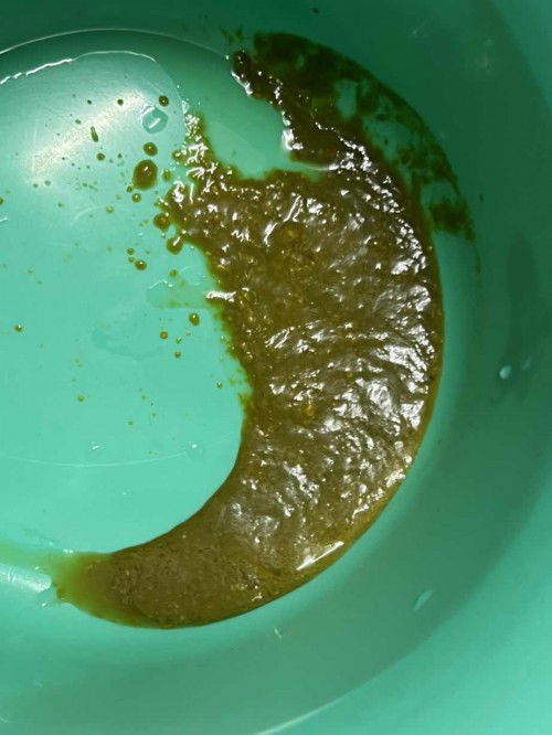 Baby 2months poop should be colour ?