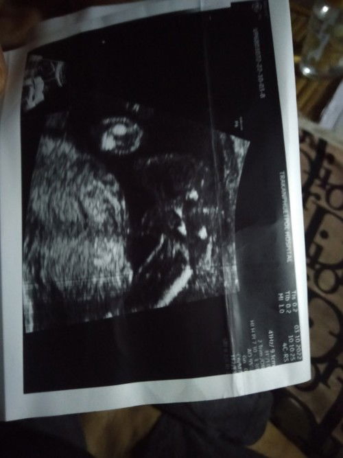 ดูไม่ออกน้องเพศชายจริงไหม