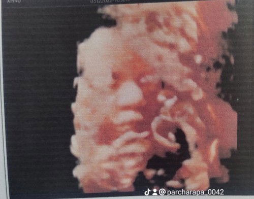 28 วีค 5วัน น้ำหนัก1,200กรัมแล้วค่าบแม่ๆ แม่บ้านอื่นน้องน้ำหนักเท่าไหร่แล้วค่าบ