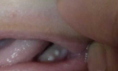 ลูก4เดือน10วัน