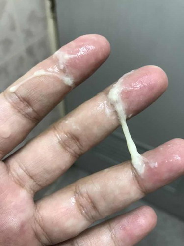 แบบนี้ต้องไปโรงพยาบาลไหม