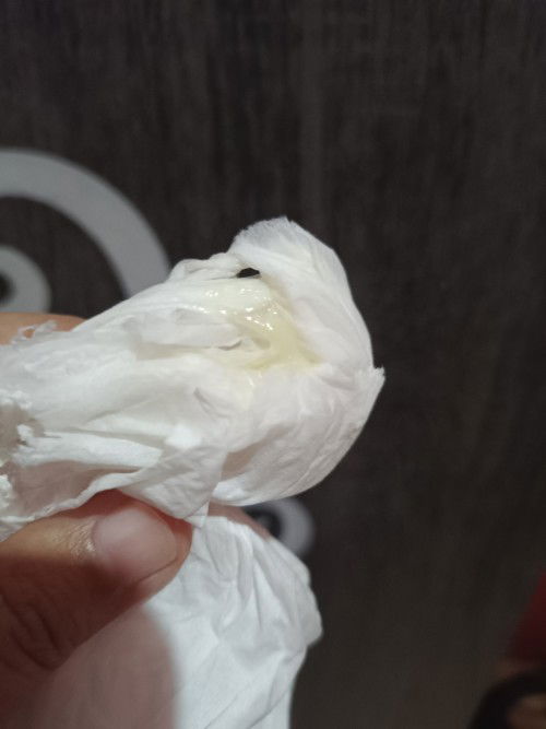 Keluar keputihan setelah berhubungan