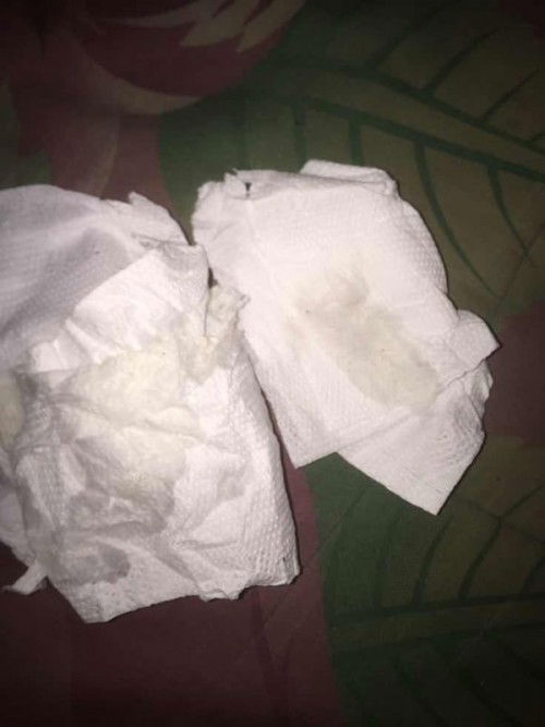 มีน้ำใสๆไหลออกมาจากช่องคลอด