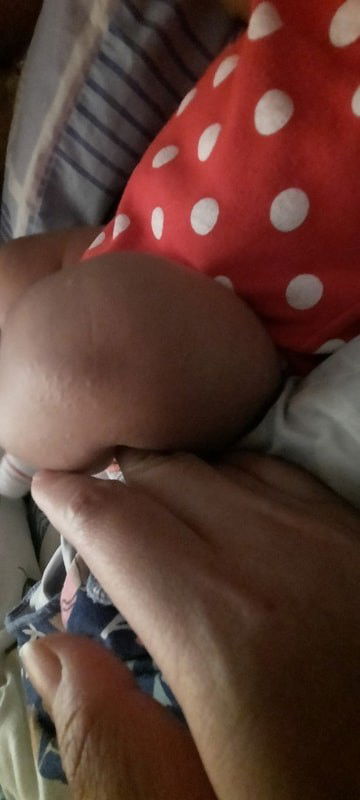 Hi to all mummy I want to knw what is a white small spot on her leg and also hand. I'm quite worried