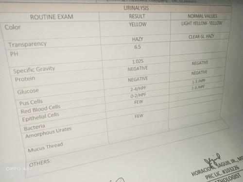 Urinalysis results