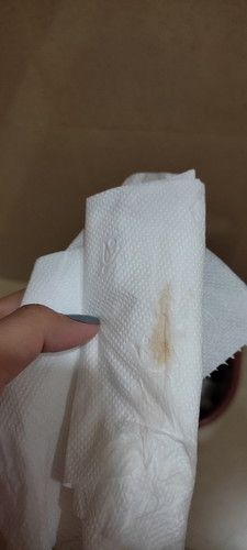 Normal lang po ba or need ko na magworry?