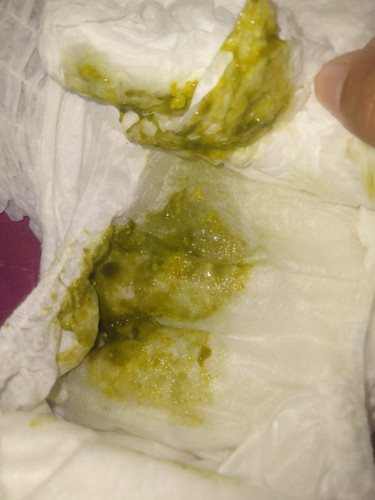 ท้องเสียหรือเปล่า??