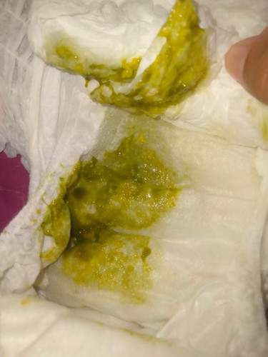 ท้องเสียหรือเปล่า?