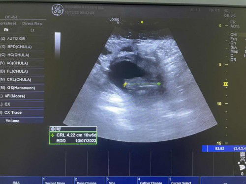 มีใครทีมกรกฎา บ้างค่ะ ขอเสียงหน่อย