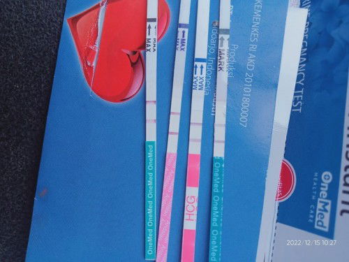 Kembali hamil setelah 1thn  yang lalu hamil Ektopik