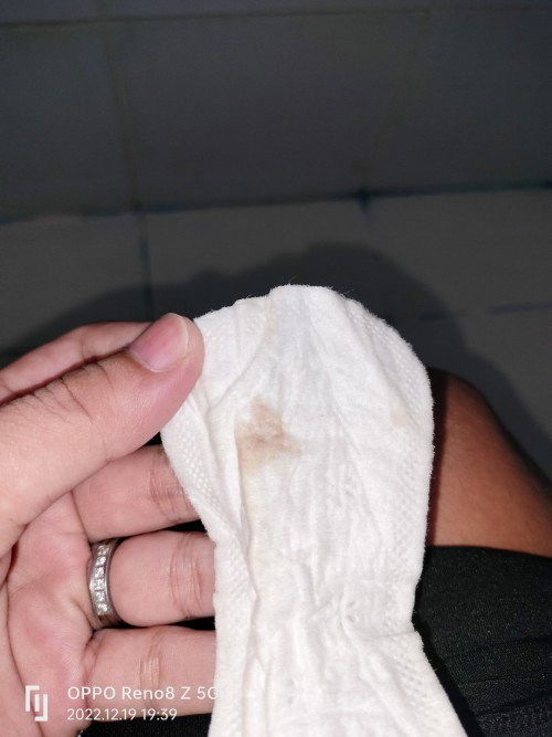38w4days . No pain. 2-3cm blood spot