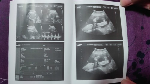 baby girl?