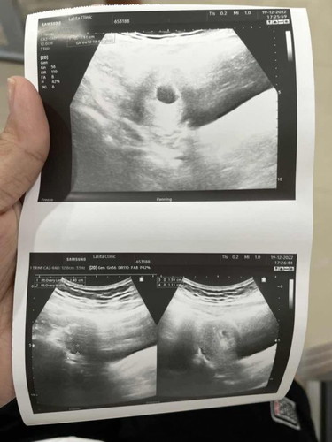 ท้องได้5week ค่ะอยากทราบว่าจะได้ยินเสียงหัวใจและเห็นเจ้าตัวเล็กตอนกี่weekค่ะ